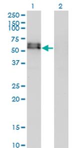 ACVR1 Antibody in Western Blot (WB)