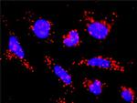 ACVR1B Antibody in Proximity Ligation Assay (PLA) (PLA)