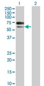 ACVRL1 Antibody in Western Blot (WB)