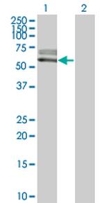 ACVRL1 Antibody in Western Blot (WB)