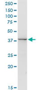 ACY1 Antibody in Western Blot (WB)