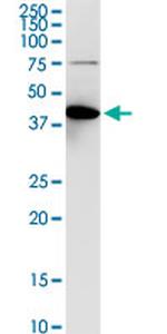 ACY1 Antibody in Western Blot (WB)