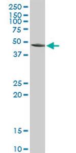 ACY1 Antibody in Western Blot (WB)