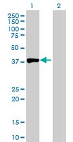 ACY1 Antibody in Western Blot (WB)