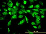 ACY1 Antibody in Immunocytochemistry (ICC/IF)