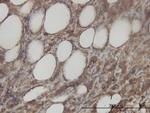 ACY1 Antibody in Immunohistochemistry (Paraffin) (IHC (P))