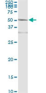 ACY1 Antibody in Immunoprecipitation (IP)