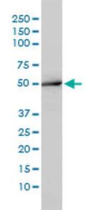 ACY1 Antibody in Western Blot (WB)