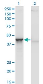 ACY1 Antibody in Western Blot (WB)