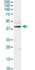 ADA Antibody in Western Blot (WB)