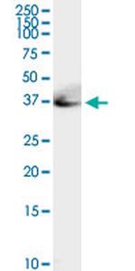 ADA Antibody in Western Blot (WB)