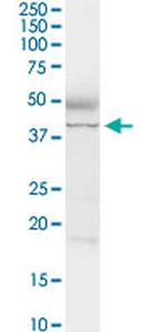 ADA Antibody in Western Blot (WB)