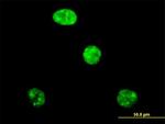 ADAR Antibody in Immunocytochemistry (ICC/IF)