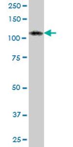 ADAR Antibody in Western Blot (WB)