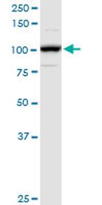 ADAR Antibody in Western Blot (WB)