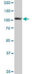 ADAR Antibody in Western Blot (WB)