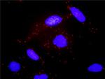 ADCY2 Antibody in Proximity Ligation Assay (PLA) (PLA)