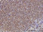 ADD1 Antibody in Immunohistochemistry (Paraffin) (IHC (P))