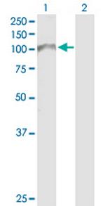 ADD2 Antibody in Western Blot (WB)