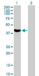 ADH1C Antibody in Western Blot (WB)