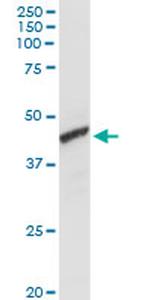 ADH1C Antibody in Western Blot (WB)