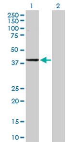 ADH1C Antibody in Western Blot (WB)