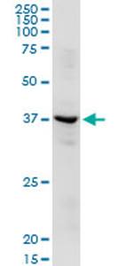 ADH1C Antibody in Western Blot (WB)