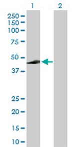 ADH7 Antibody in Western Blot (WB)