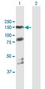 PARP1 Antibody in Western Blot (WB)