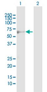 ADRB3 Antibody in Western Blot (WB)