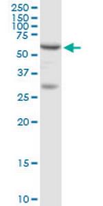 ADSL Antibody in Western Blot (WB)