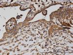 AP2B1 Antibody in Immunohistochemistry (Paraffin) (IHC (P))