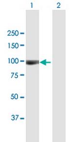 ACAN Antibody in Western Blot (WB)