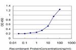 AGER Antibody in ELISA (ELISA)