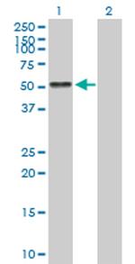 AGT Antibody in Western Blot (WB)