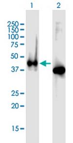 APLNR Antibody in Western Blot (WB)