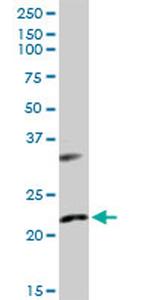 AK1 Antibody in Western Blot (WB)