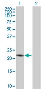 AK1 Antibody in Western Blot (WB)