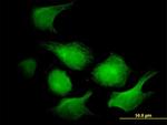 AK1 Antibody in Immunocytochemistry (ICC/IF)