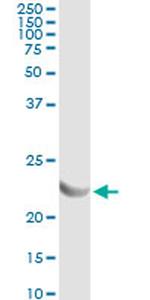 AK1 Antibody in Immunoprecipitation (IP)