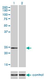 AK1 Antibody in Western Blot (WB)