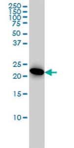 AK1 Antibody in Western Blot (WB)