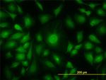 AK1 Antibody in Immunocytochemistry (ICC/IF)