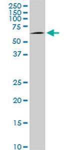 AKT1 Antibody in Western Blot (WB)