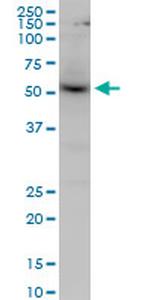 AKT1 Antibody in Western Blot (WB)