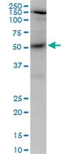 AKT1 Antibody in Western Blot (WB)