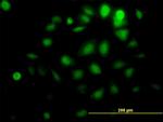 AKT1 Antibody in Immunocytochemistry (ICC/IF)