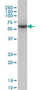 AKT1 Antibody in Western Blot (WB)