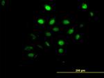 AKT1 Antibody in Immunocytochemistry (ICC/IF)