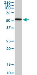 AKT1 Antibody in Western Blot (WB)